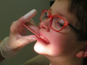 ortodonciainvisible niño