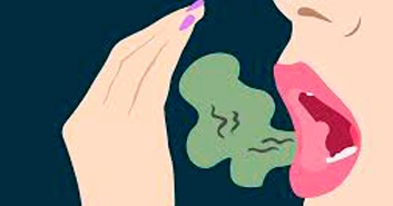 halitosis boca