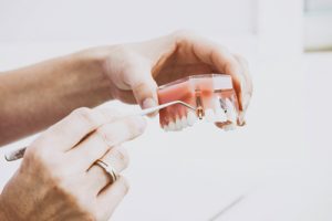 Prótesis dental fija o removible: ¿qué tipo elegir?