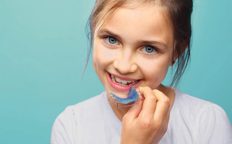 Retenedor de ortodoncia infantil