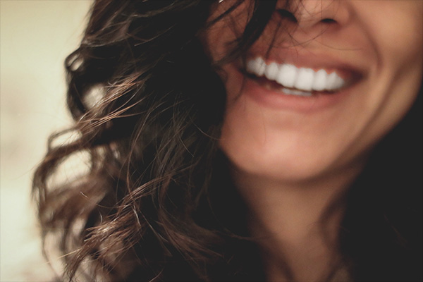 carillas dentales