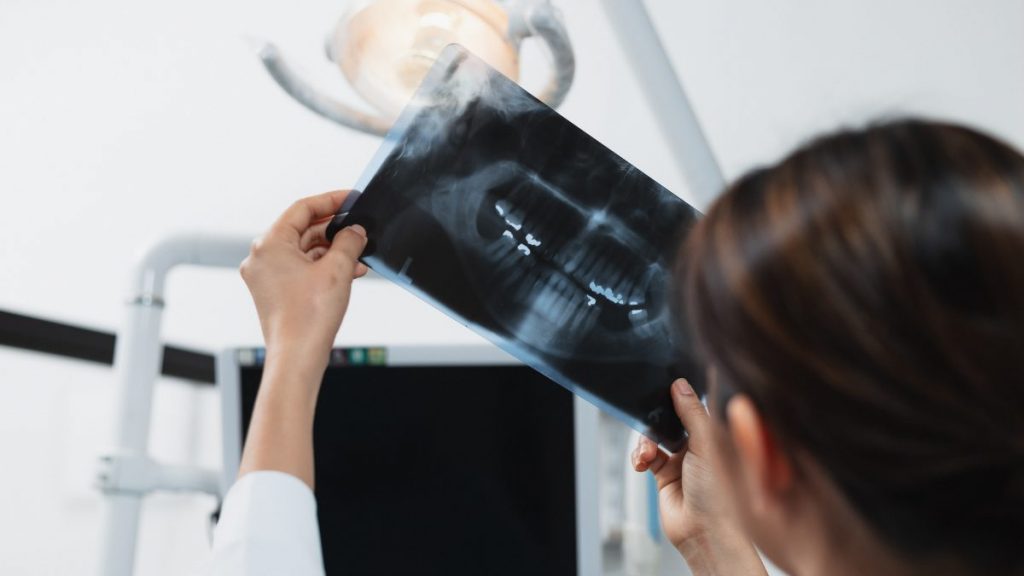 La importancia de un buen control radiográfico en el diagnóstico de caries