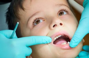 Manejo de la ansiedad dental en niños