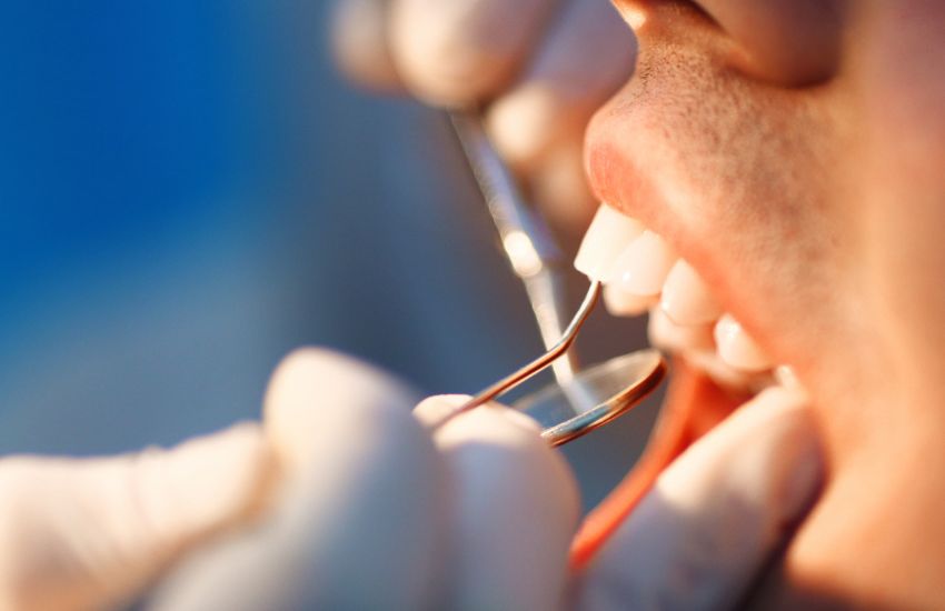 ¿En qué consiste una pulpotomía dental
