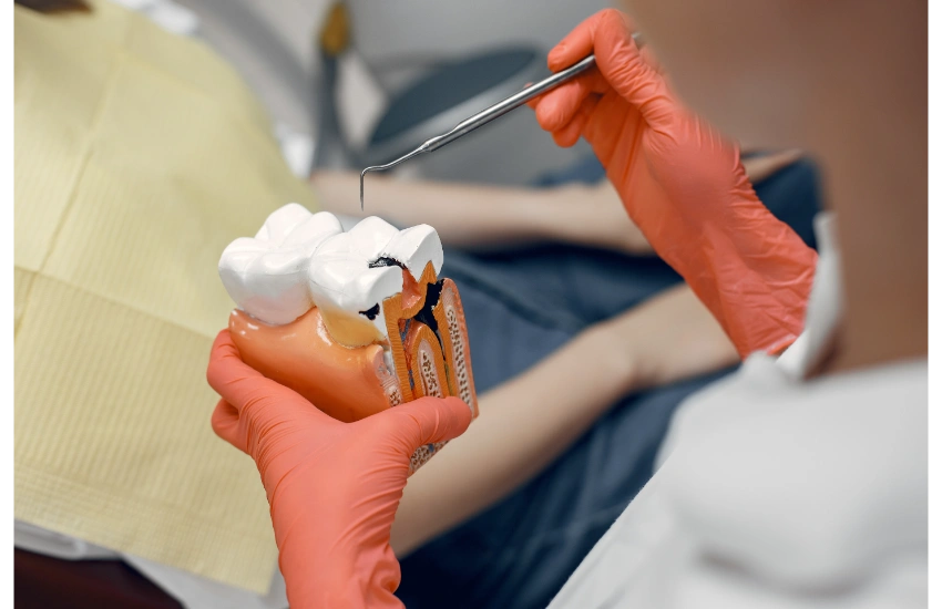 Endodoncia birradicular: Qué es y cuándo se realiza