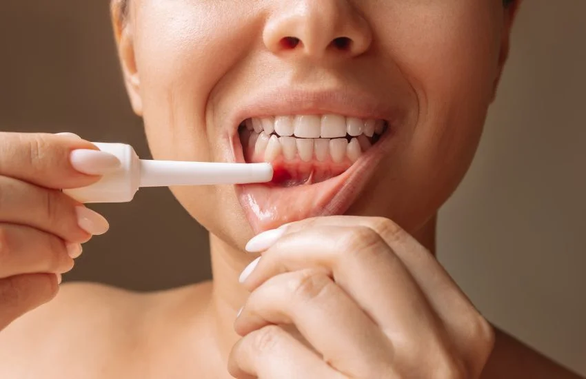 Mujer mostrando encías enrojecidas mientras aplica un gel para tratar problemas periodontales.